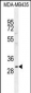 CLEC10A Antibody (N-term)